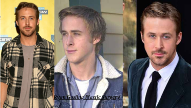 Ryan Gosling Plastic Surgery