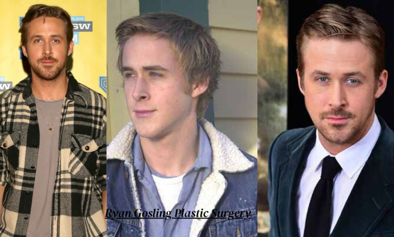 Ryan Gosling Plastic Surgery
